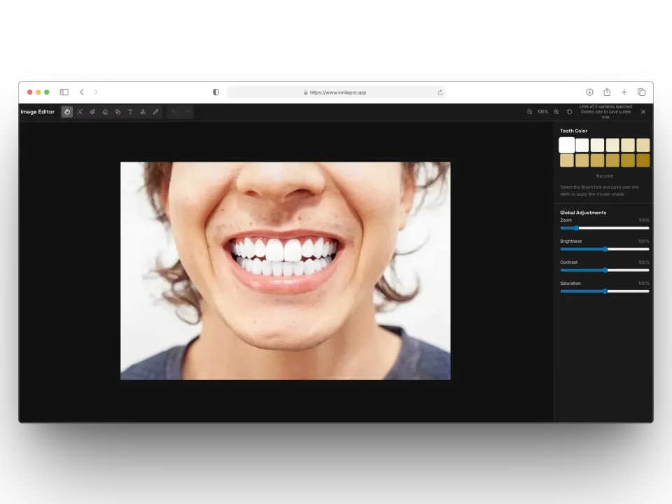Editor de imágenes de SmilePro con paleta de tonos dentales y controles de brillo, contraste y saturación